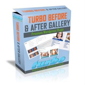 The Turbo Before & After Gallery
